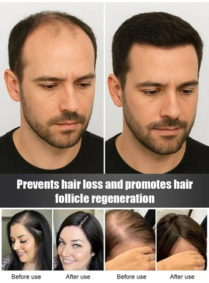 Hair Growth and Blackening Spray✨