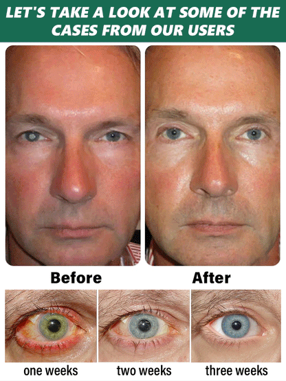 FDA Certified (USA) – Nano Vision Repair Eye Serum