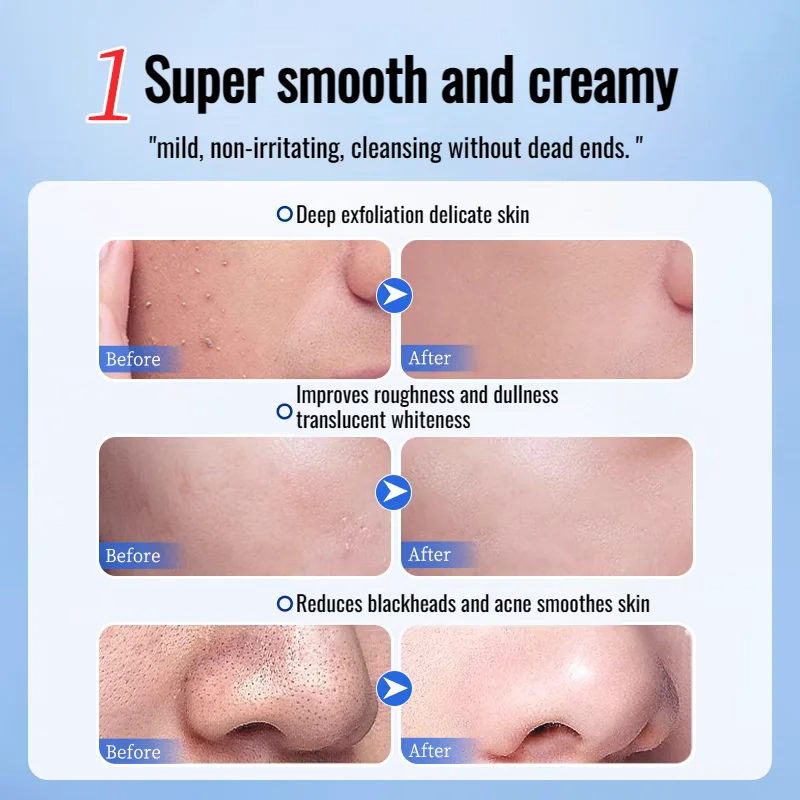 Herbal Exfoliating Gel - Skin Moisturizing Exfoliating Gentle Cleansing Gel Deep Brightening Gel