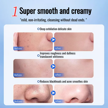 Herbal Exfoliating Gel - Skin Moisturizing Exfoliating Gentle Cleansing Gel Deep Brightening Gel