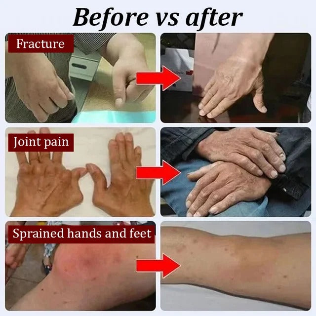 Deer Gum Glucosamine Bone Penetrating Health Patch