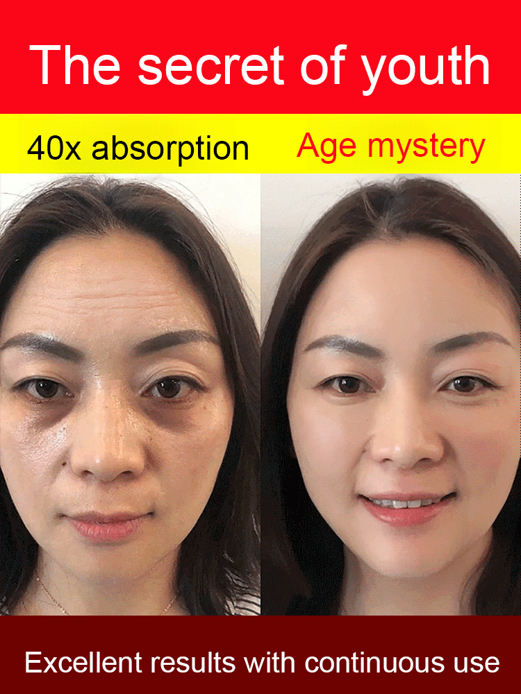 [Skin counter growth] Collagen anti wrinkle essence