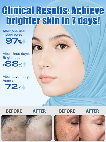 [Deep Cleanser] Spot-Fading Gentle Facial Cleanser