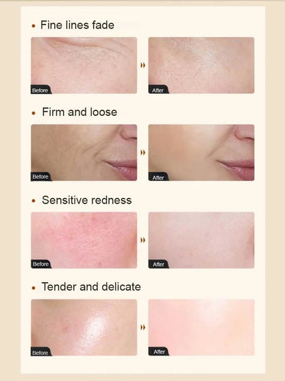 [Skin counter growth] Collagen anti wrinkle essence